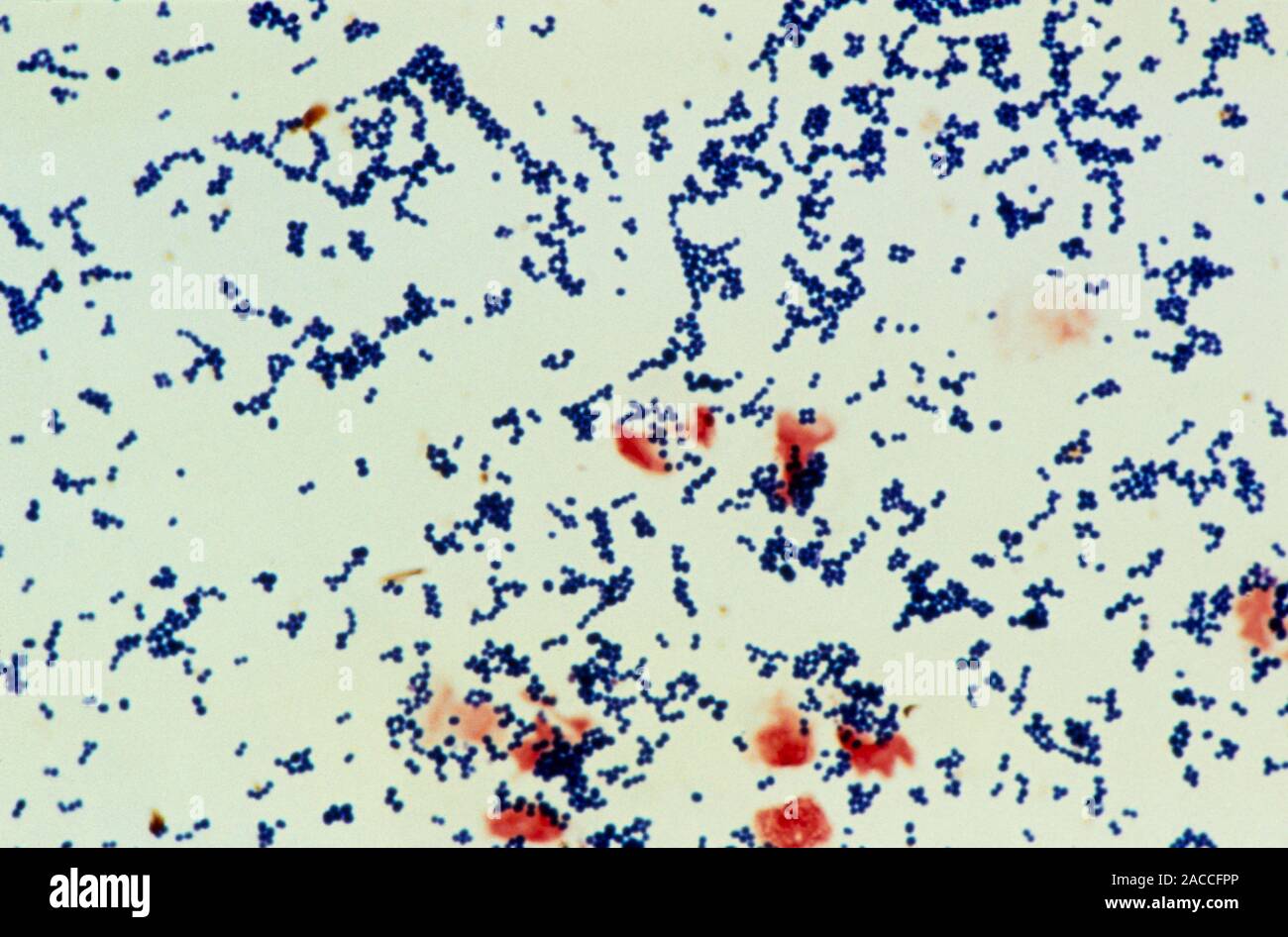 Light micrograph of Staphylococcus epidermidis (formerly albus), a Gram