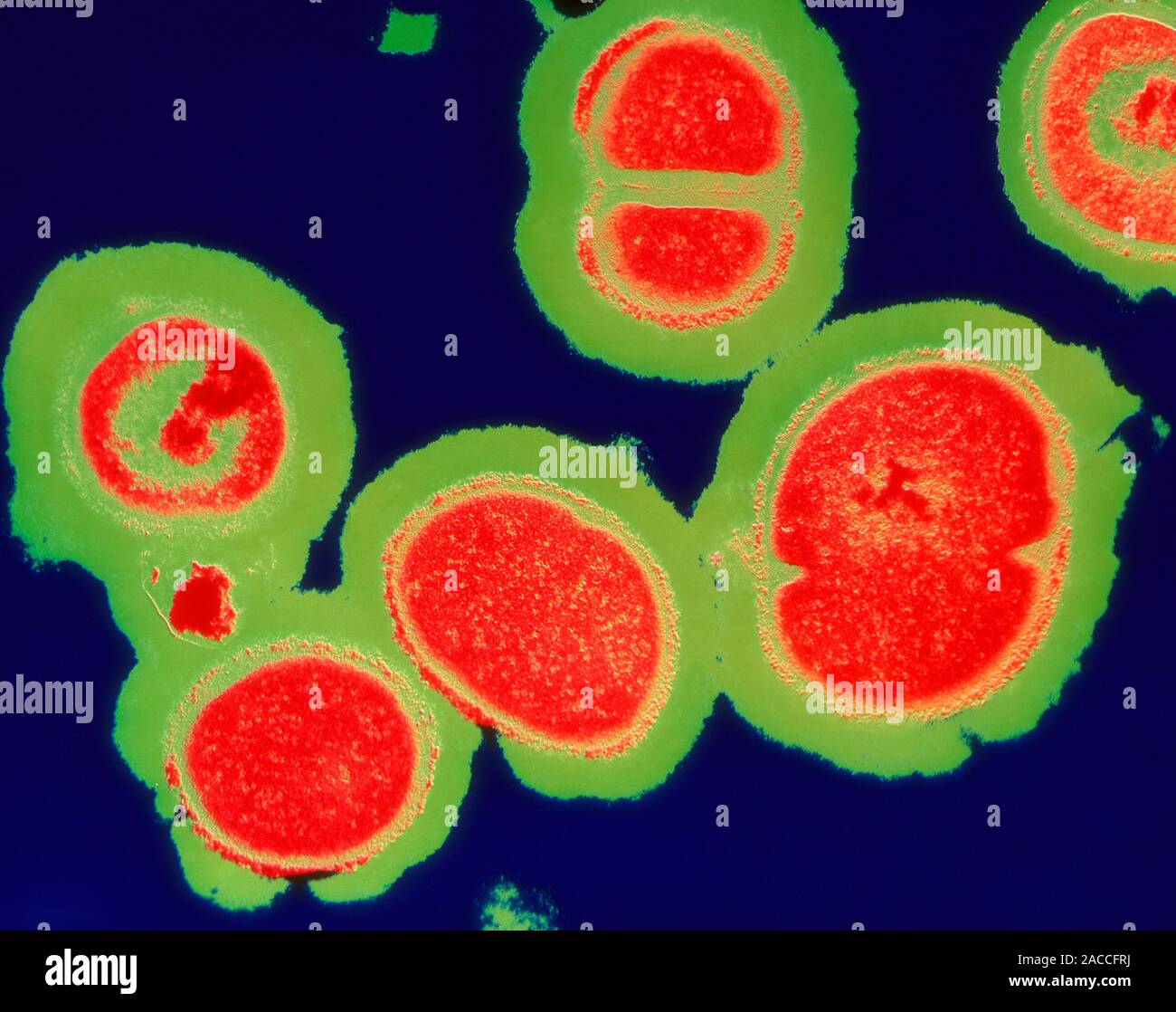 MRSA resistant Staphylococcus bacteria. Coloured transmission electron
