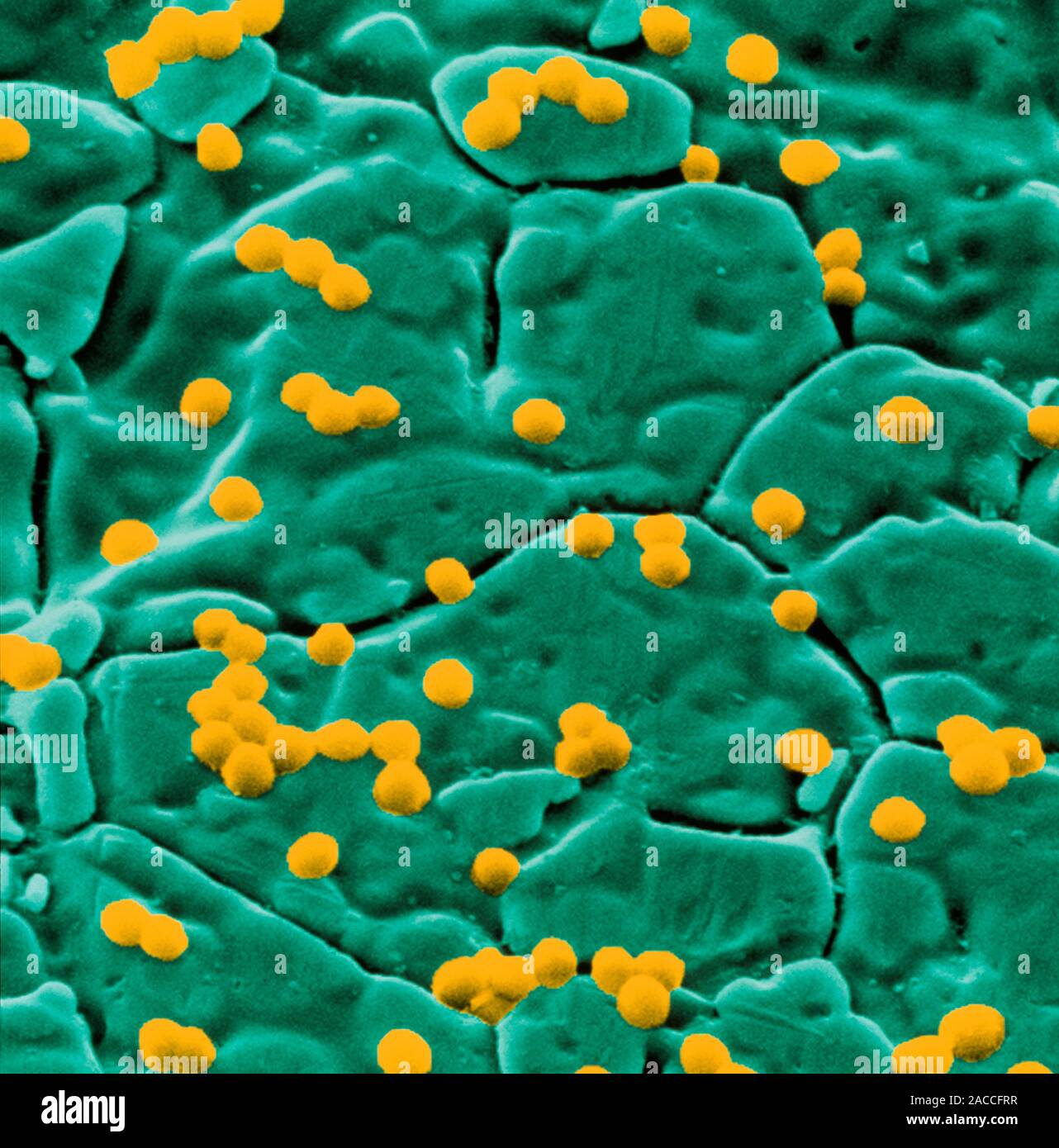 Staphylococcus aureus. Coloured Scanning Electron Micrograph (SEM) of Staphylococcus aureus