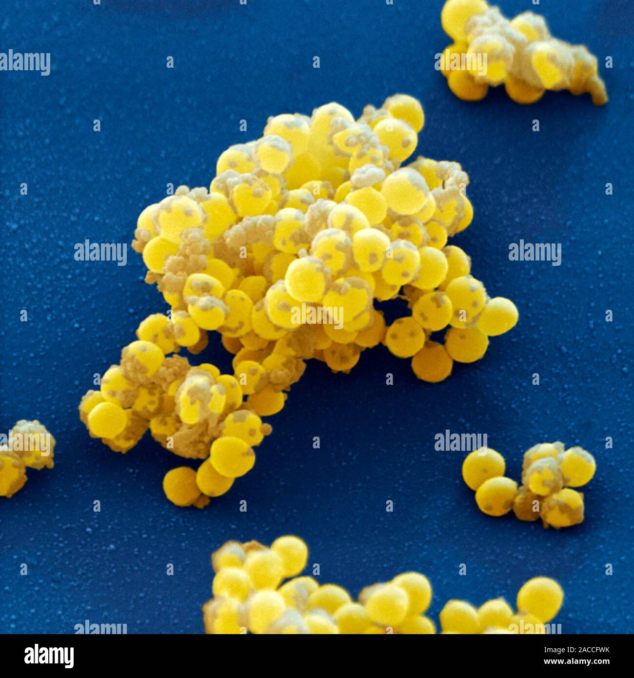 Staphylococcus aureus золотистый стафилококк. S. aureus золотистый стафилококк. Метициллин-резистентный золотистый стафилококк. Гемокультура золотистый стафилококк. Стафилококк золотистый Staphylococcus aureus.
