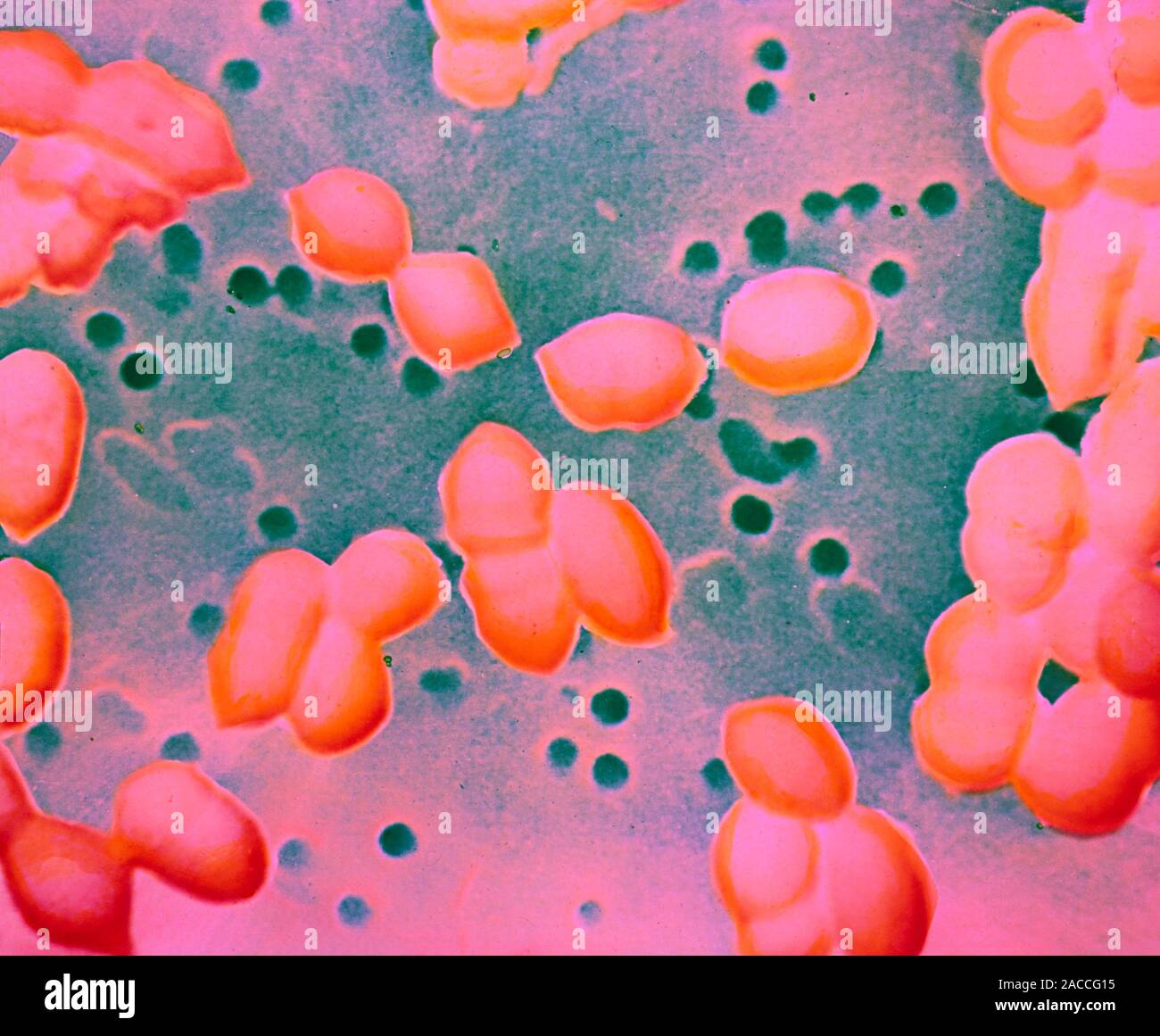 стрептококк пневмония микробиология. микроскопия стрептококк пиогенес. стафилококки стрептококки пневмококки. Pneumoniae (пневмококк возбудитель. стрептококк pneumoniae.