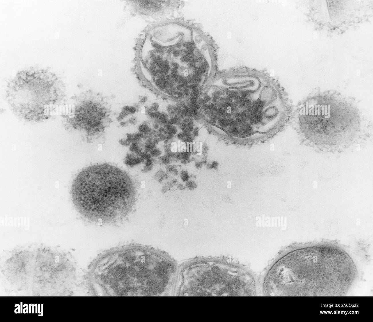 Streptococcus mutans. Transmission electron micro graph of thinsectioned Streptococcus mutans