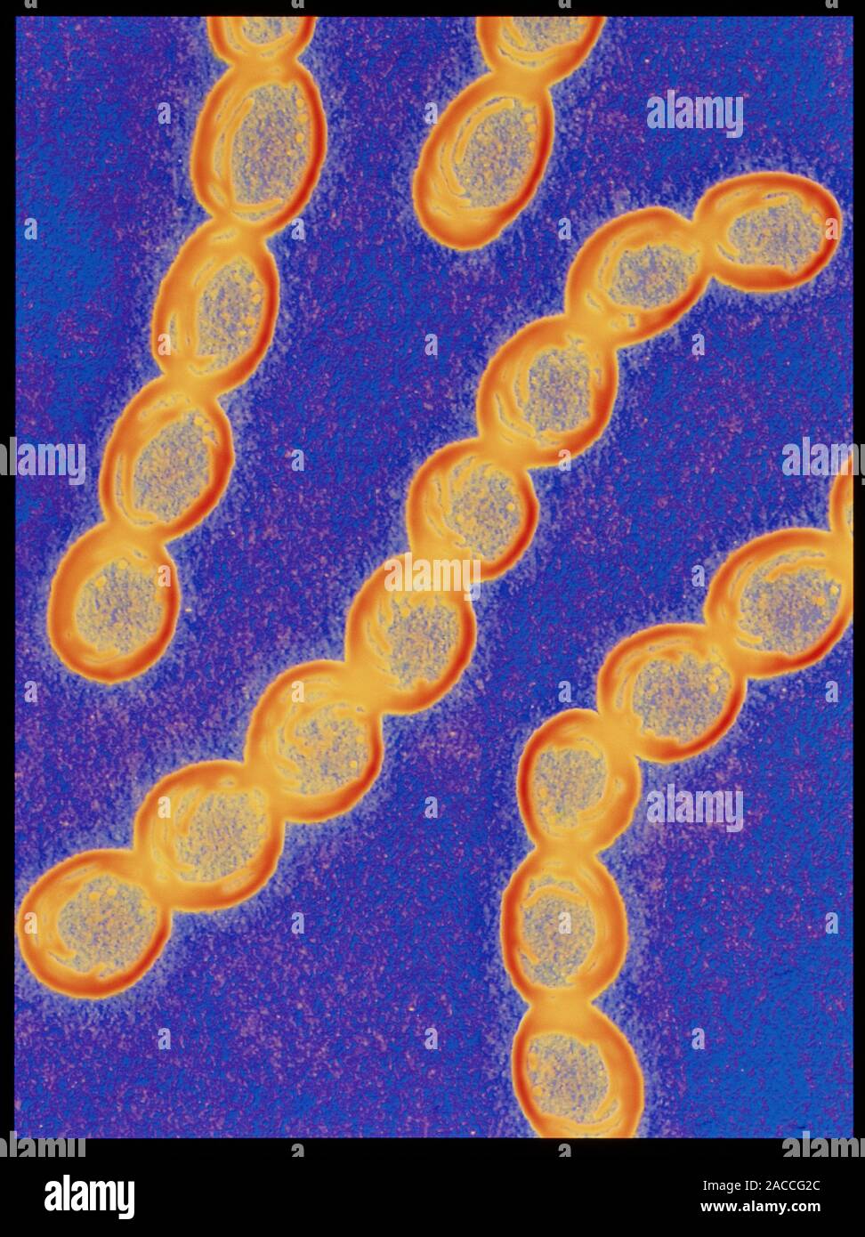 Streptococcus bacteria. Transmission electron micrograph (TEM) of