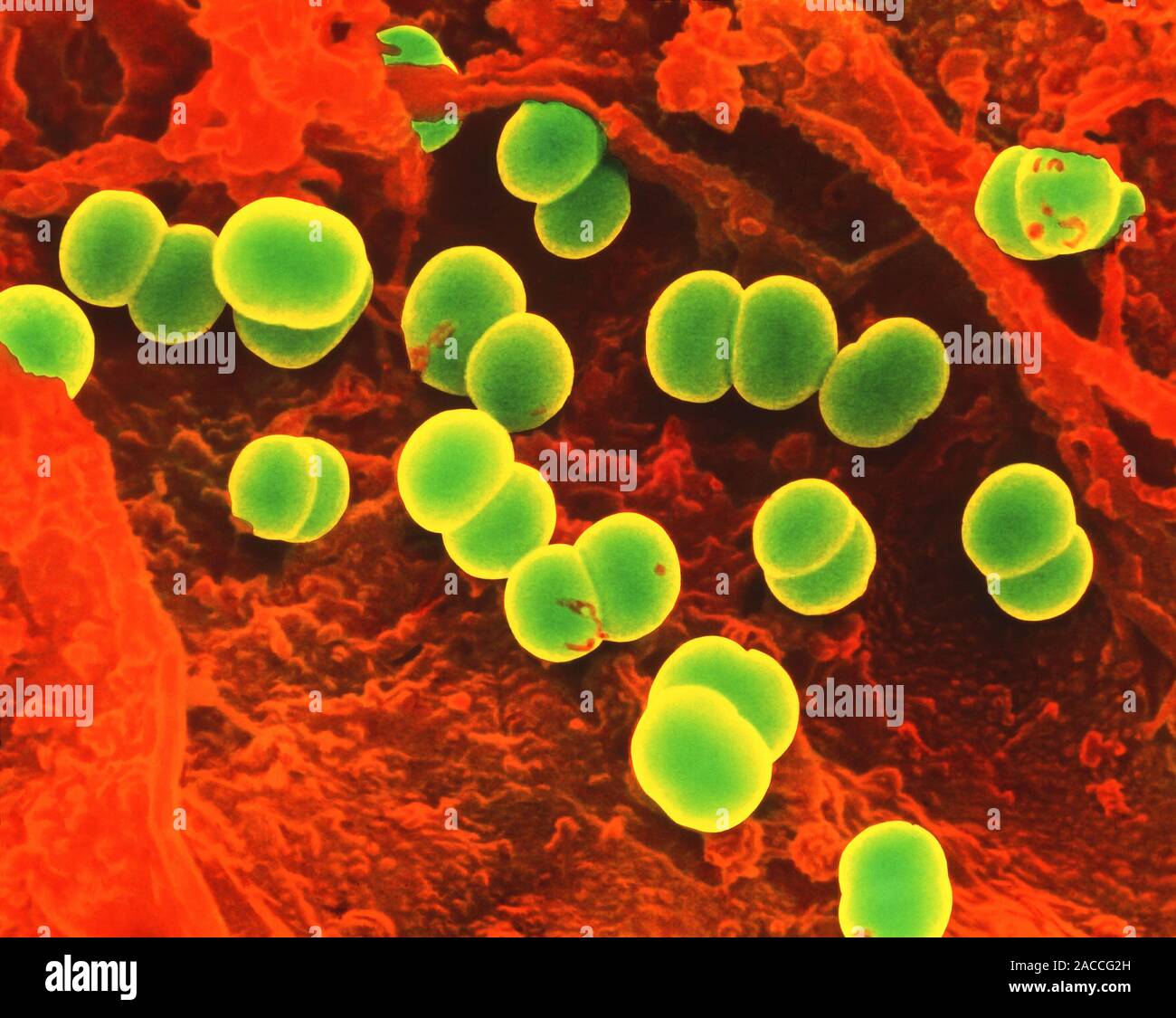 Food poisoning bacteria. Coloured scanning electron micrograph (SEM) of