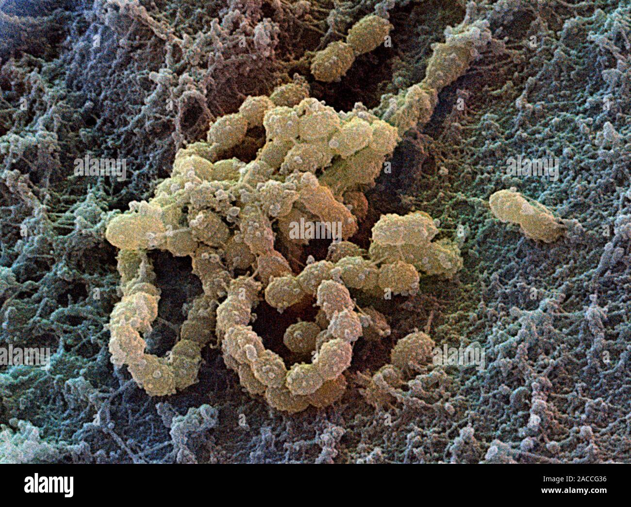 Streptococcus mutans. Coloured scanning electron micrograph (SEM) of ...