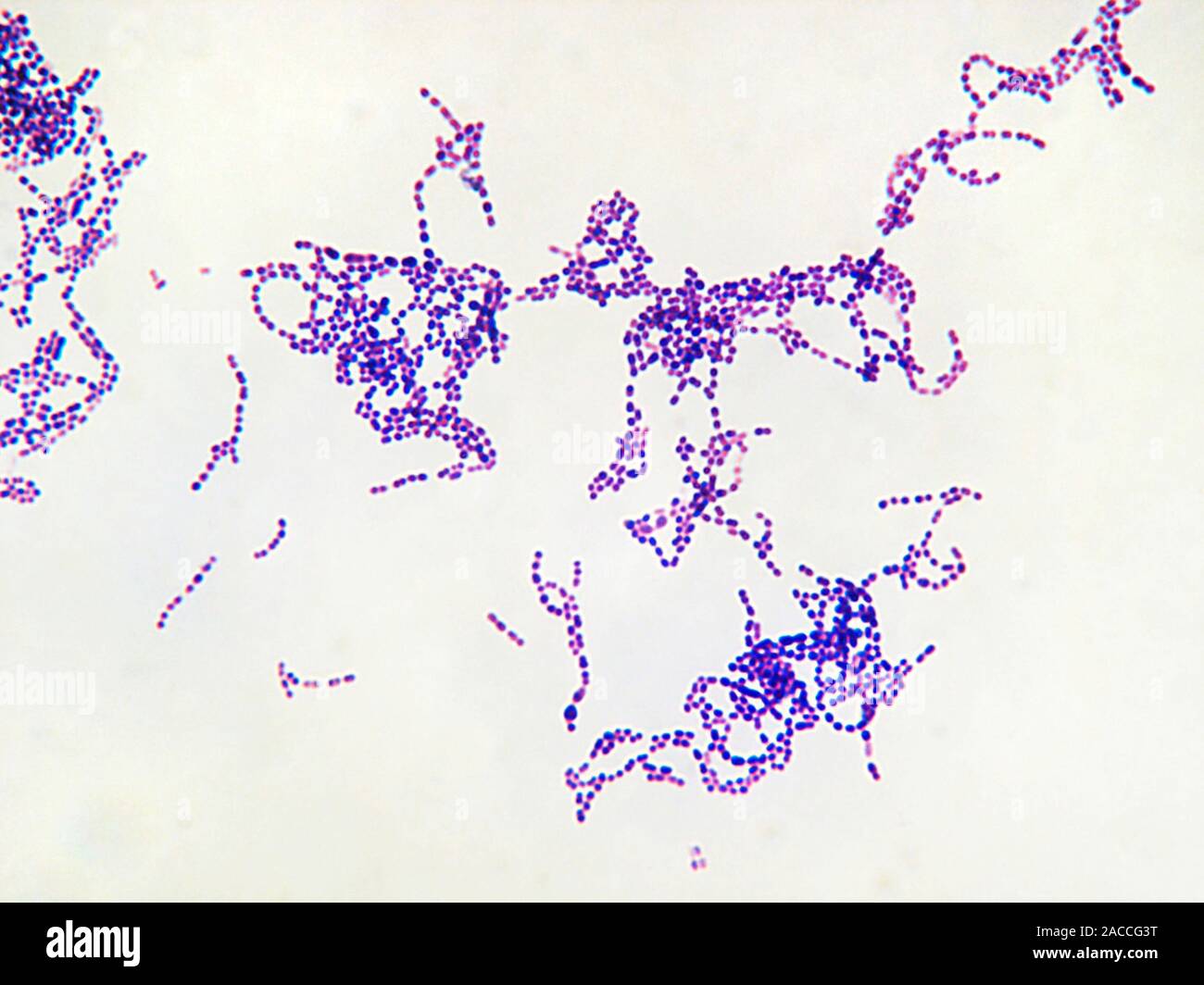 Streptococcus pyogenes bacteria, light micrograph. 
