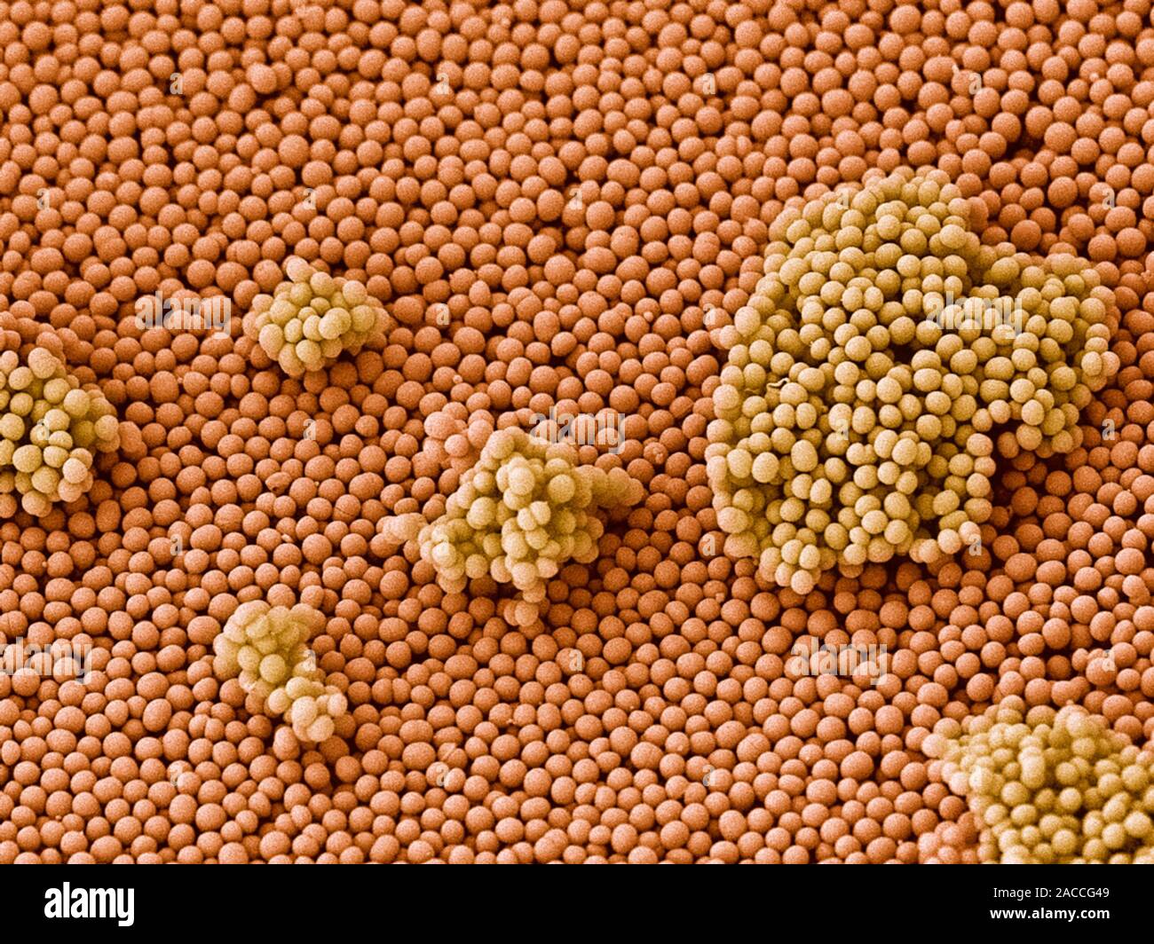 Streptococcus bacteria. Coloured scanning electron micrograph (SEM) of Streptococcus sp. bacteria. Streptococci are round Gram-positive bacteria. Some Stock Photo