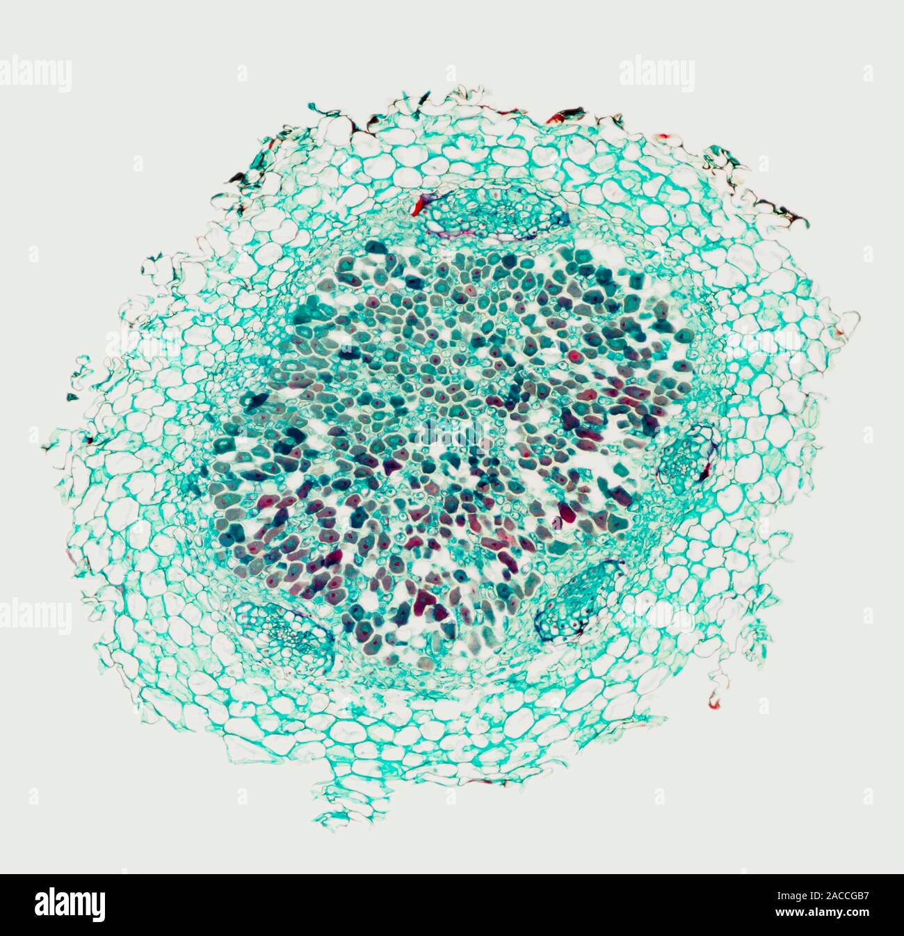 Nodulating Faba Roots Nitrogen-fixing root nodule. Light micrograph of a section through a ...