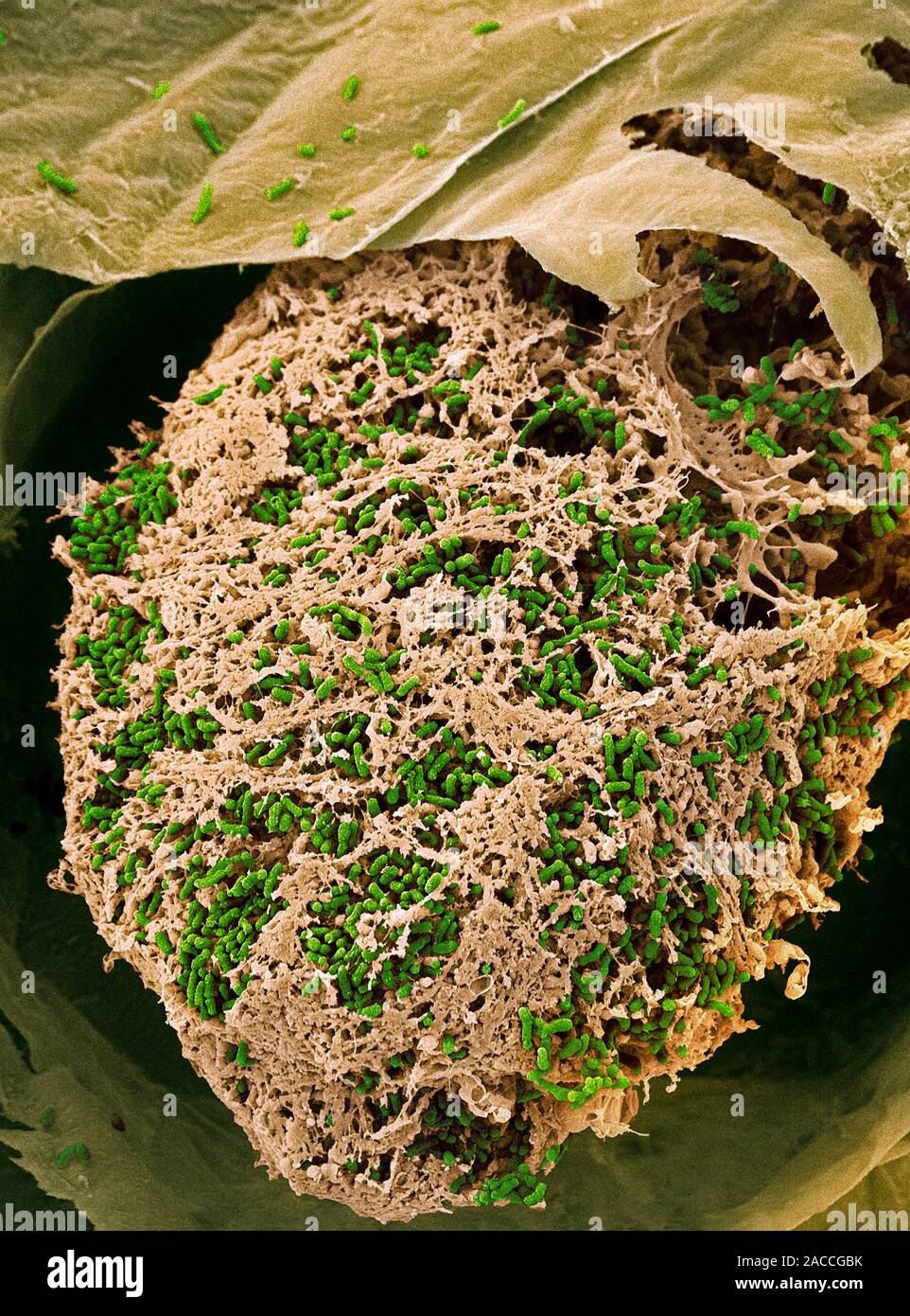 nitrogen-fixing-bacteria-coloured-scanning-electron-micrograph-sem