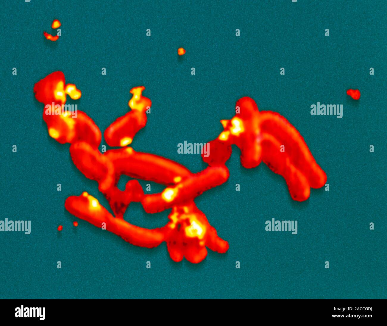Saltloving nuclearwaste bacteria. Coloured scanning electron