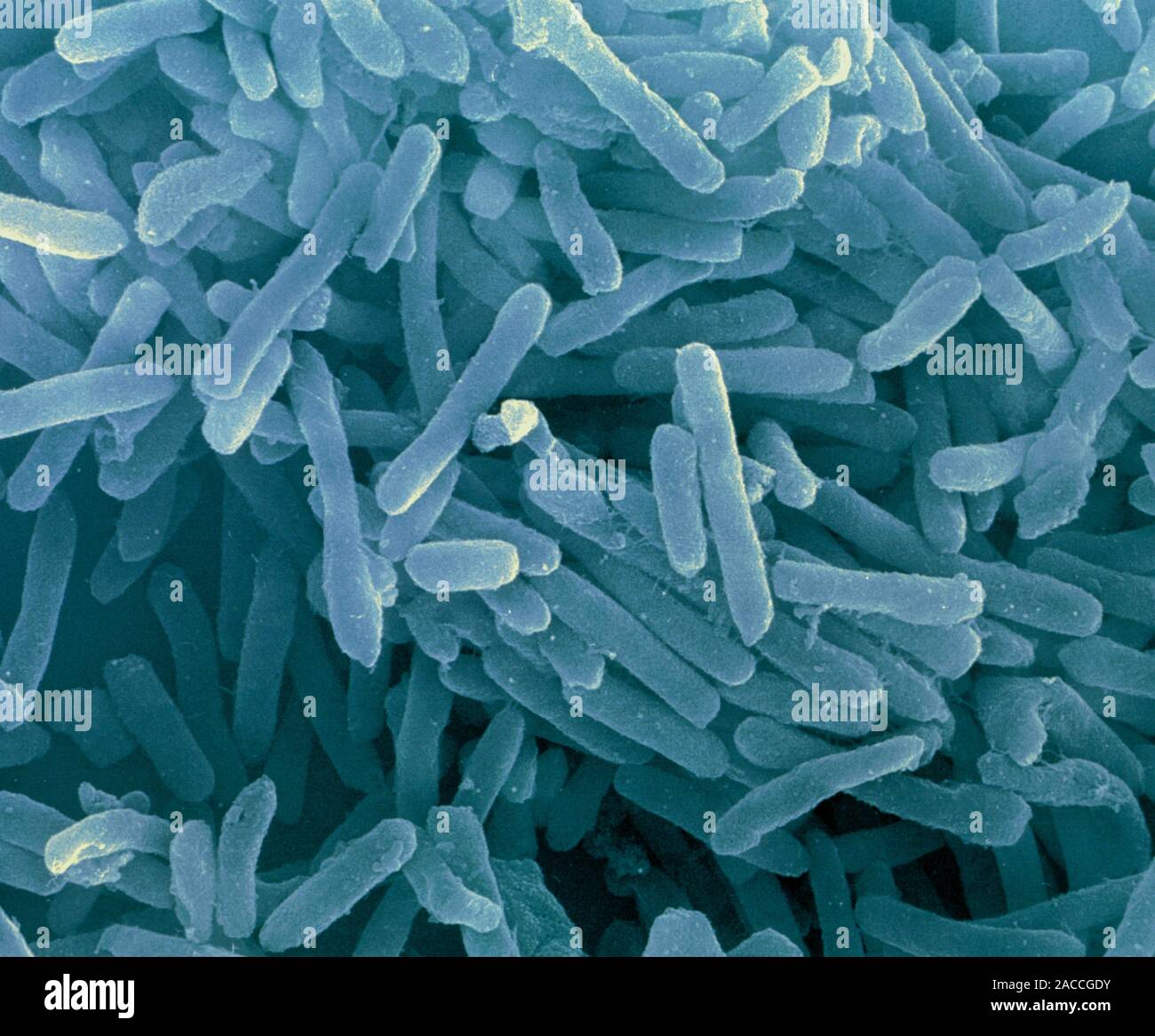 Natrialba magadii archaea. Coloured scanning electron micrograph (SEM ...