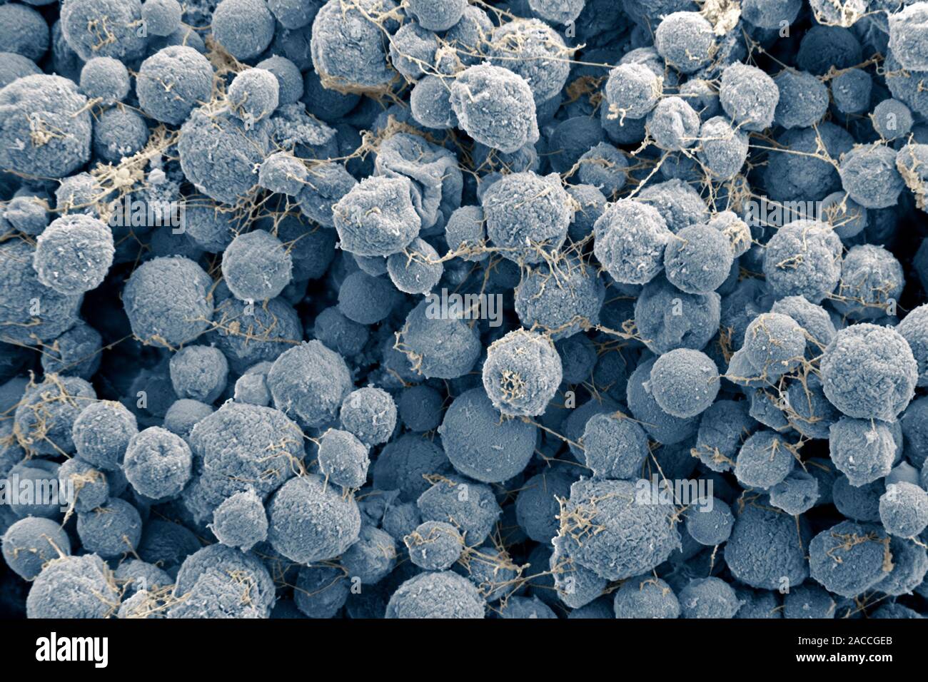 Метаногенные архебактерии. Methanosarcina mazei. Метанобразующие археи и бактерии. Факультативные метилотрофы. Неподвижные бактерии.