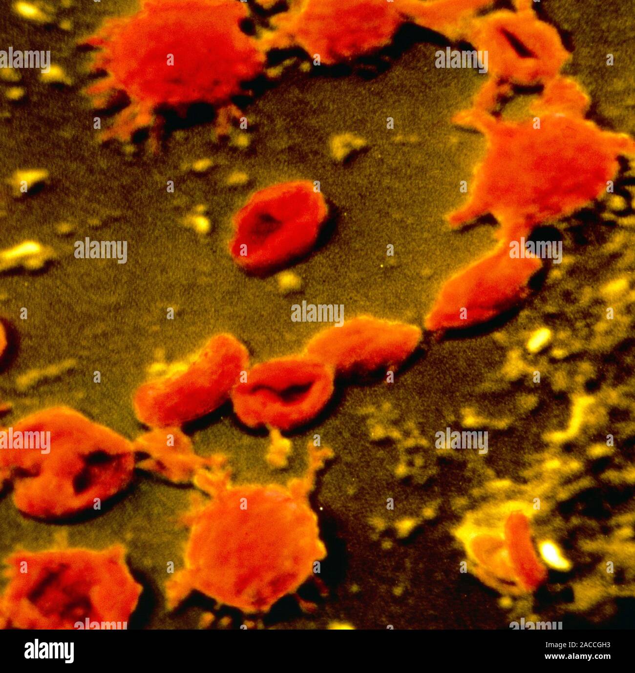 Микоплазма зев. Клетки Mycoplasma pneumoniae окружены. Микоплазма гемофелис. Микоплазма пневмония микробиология.