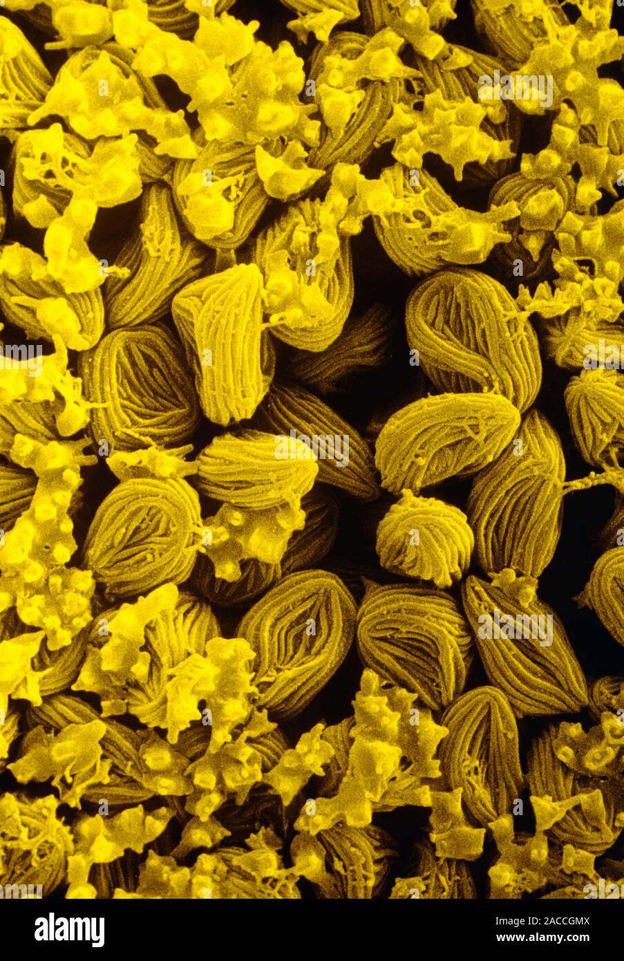 False colour scanning electron micrograph of tightly packed spores in a ...