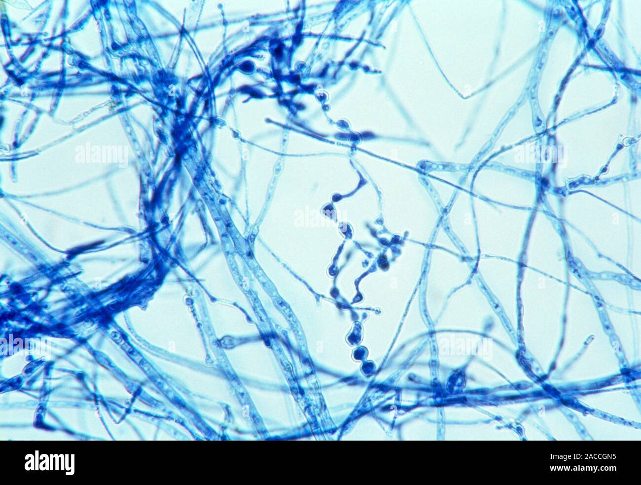 Light micrograph showing nodular hyphae of the dermatophyte fungus