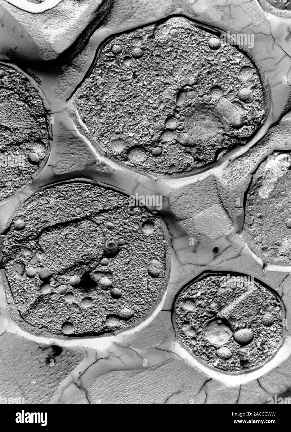 Freezefracture transmission electron micrograph of baker's yeast