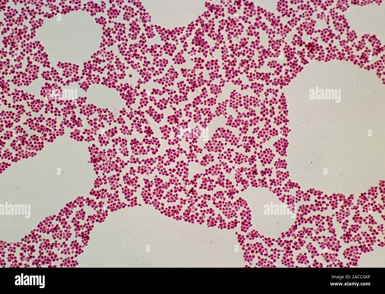 Yeast. Light micrograph of a culture of Baker's or Brewer's yeast