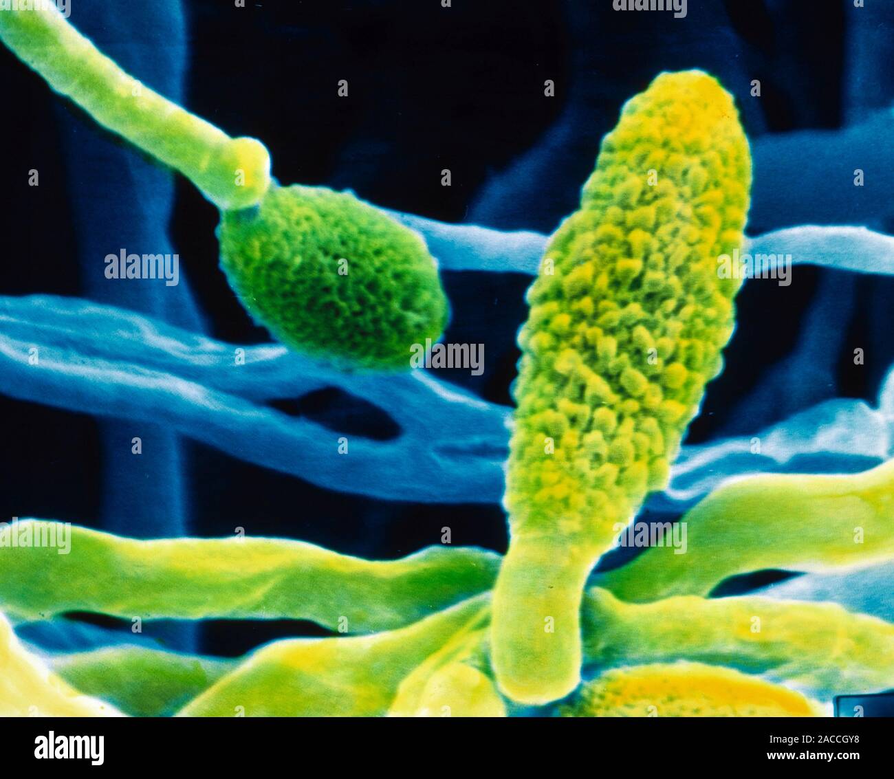 Scanning electron micrograph (SEM) of the fungus Alternaria alternata ...