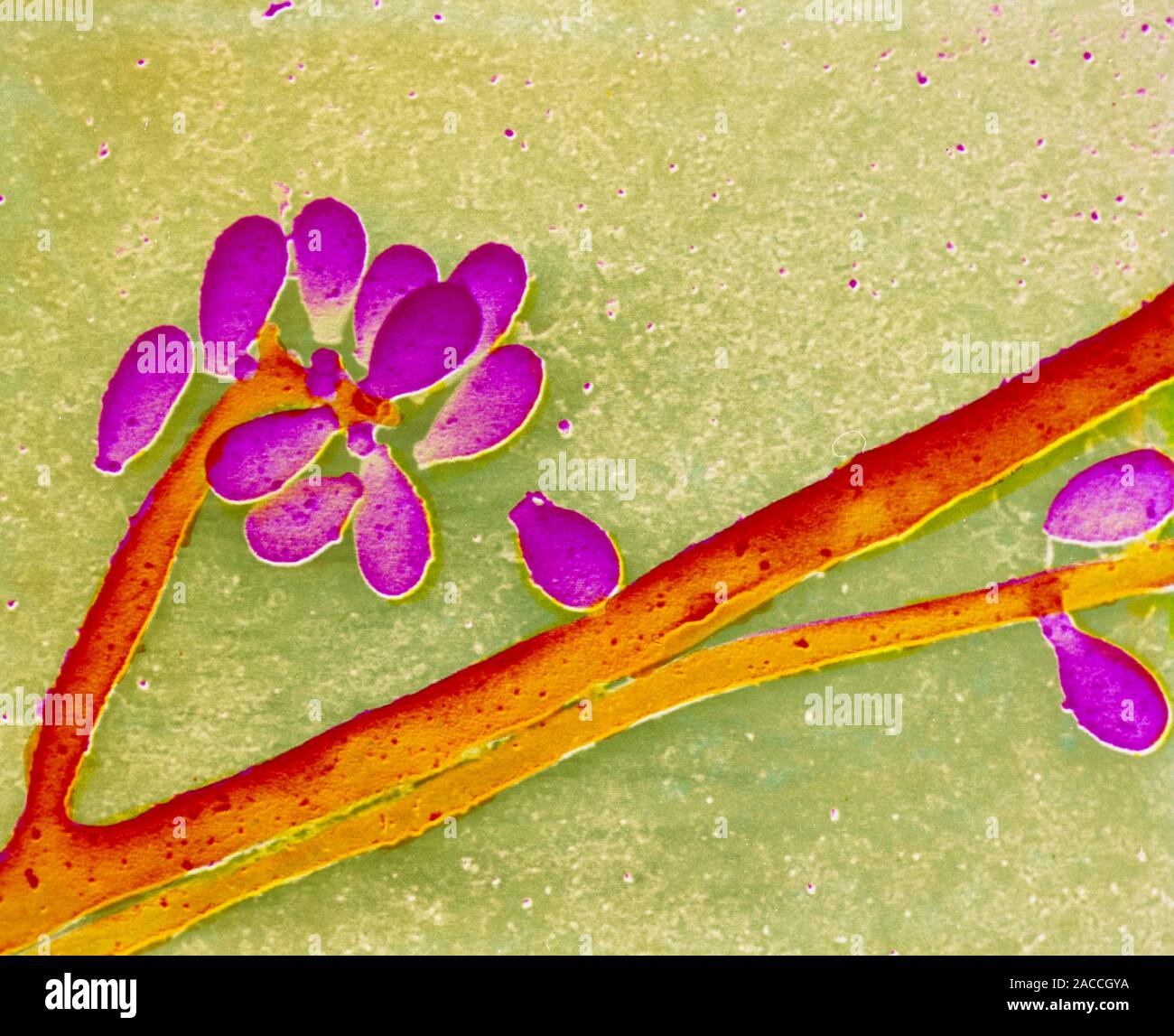 False-colour scanning electron micrograph (SEM) of the fungus ...