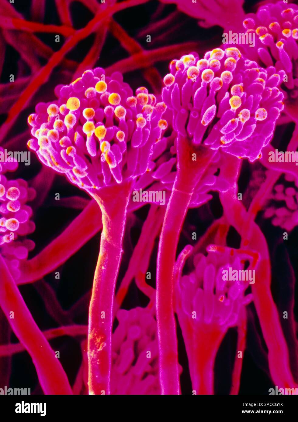False colour Scanning Electron Micrograph SEM Of The Fungus 