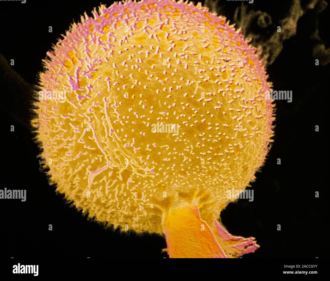 False-colour scanning electron micrograph (SEM) of a spore-producing ...