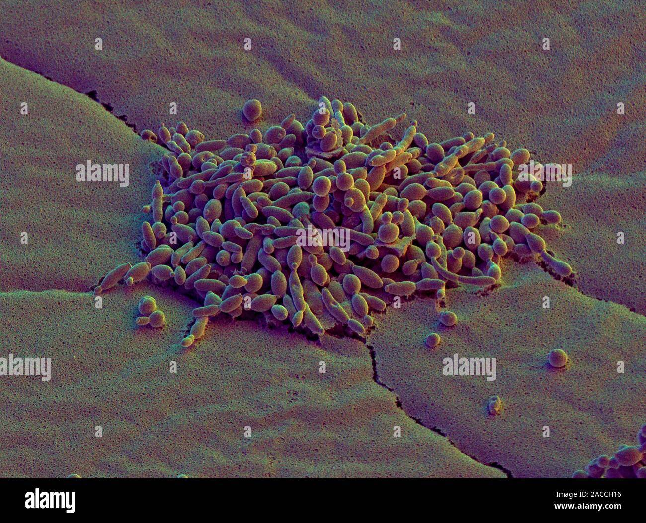 Yeast cells. Coloured Scanning Electron Micrograph (SEM) of a colony of
