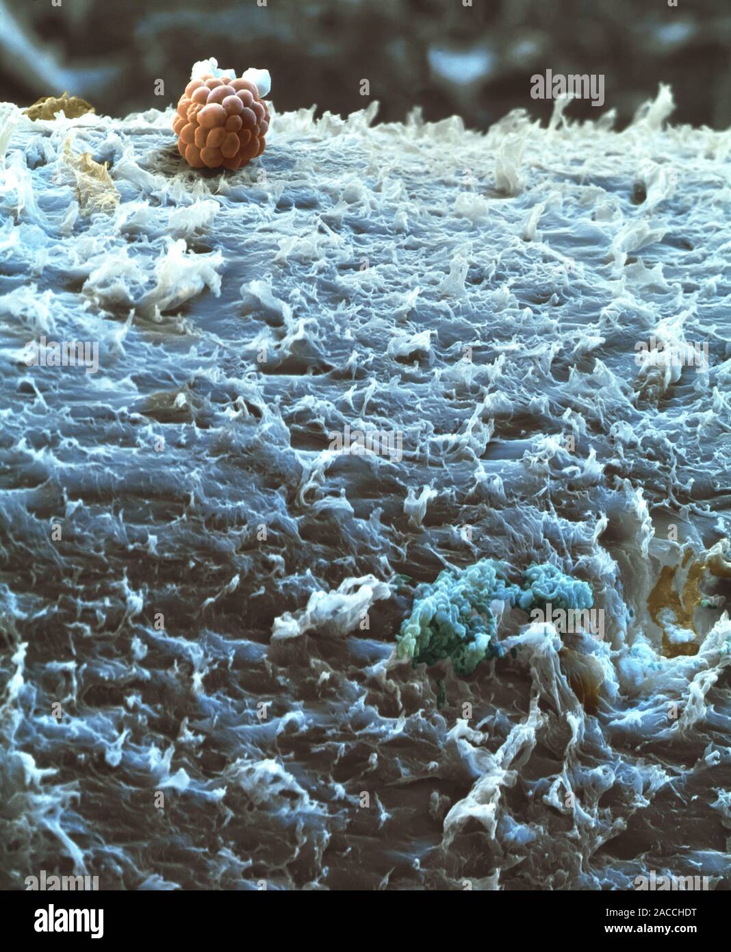 Yeast. Coloured scanning electron micrograph (SEM) of yeast cells