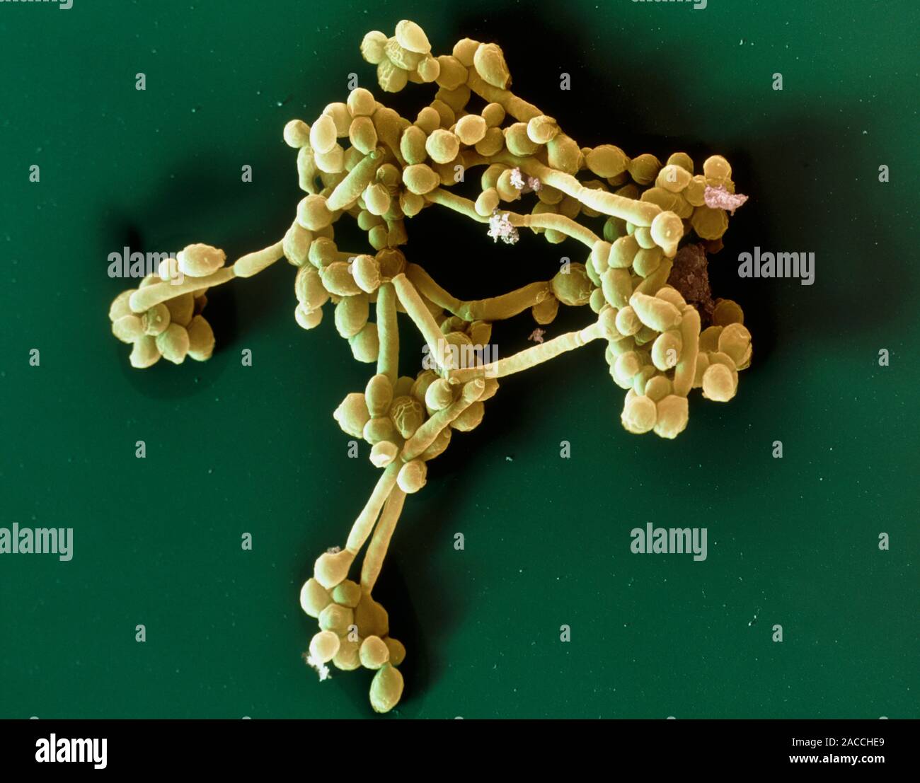 Candida Albicans Fungus Coloured Scanning Electron Micrograph Sem Of Cells Of The Yeast Like 