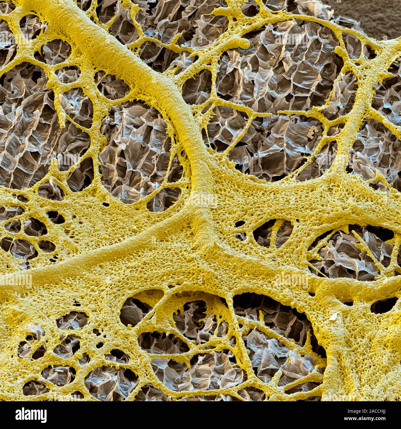Slime mould (Physarum polycephalum) feeding on the surface of an almond,  coloured scanning electron micrograph. This is the plasmodium phase of the  sl Stock Photo - Alamy