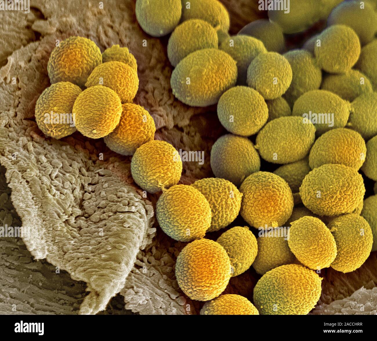 Fungal spores. Coloured scanning electron micrograph (SEM) of the