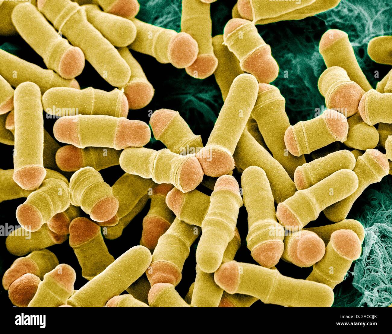 Dividing yeast cells. Coloured scanning electron micrograph (SEM) of