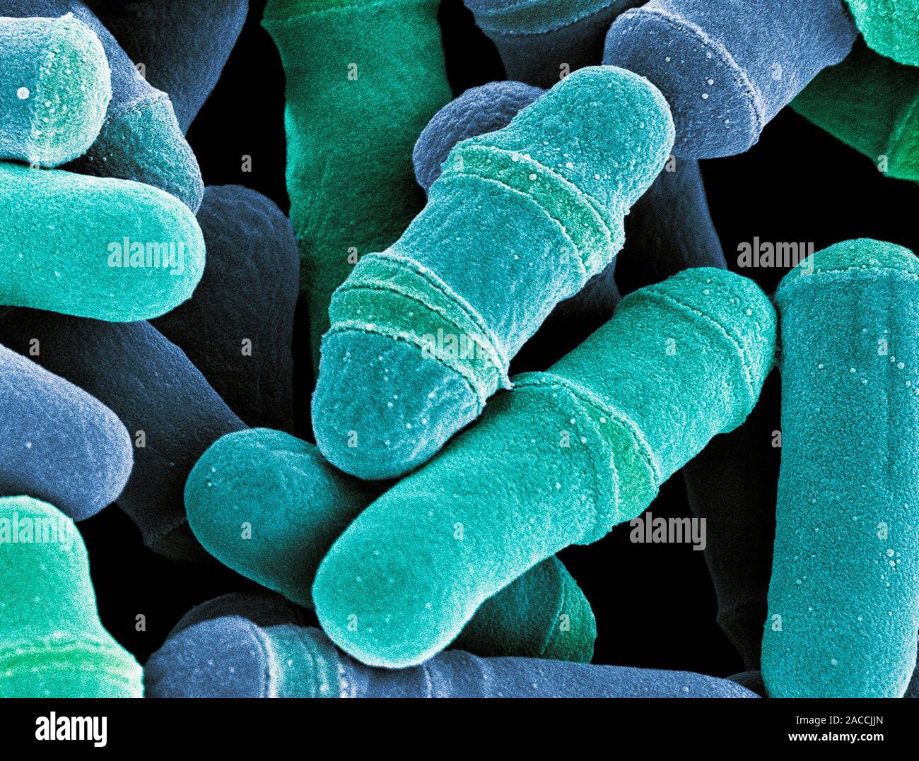 Dividing yeast cells. Coloured scanning electron micrograph (SEM) of
