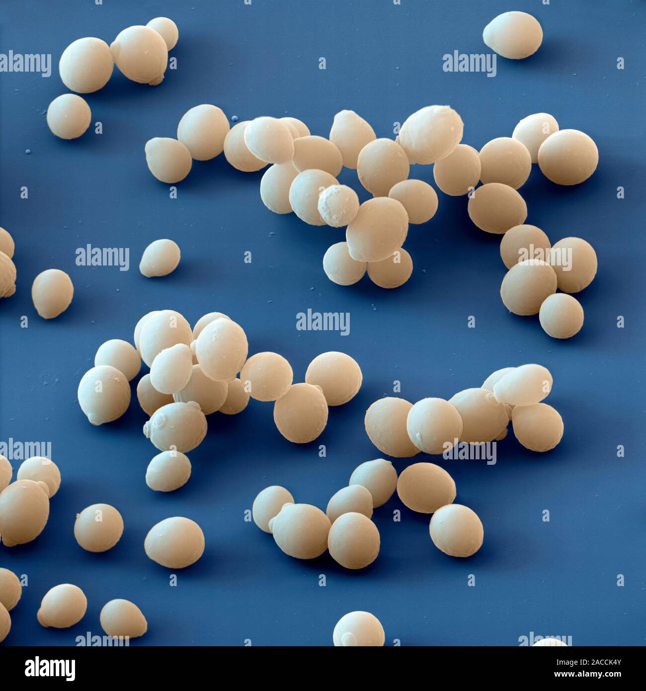Yeast cells. Coloured scanning electron micrograph (SEM) of cells