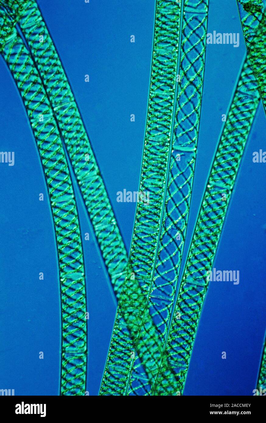 Light micrograph of filaments of Spirogyra, a green alga which forms ...