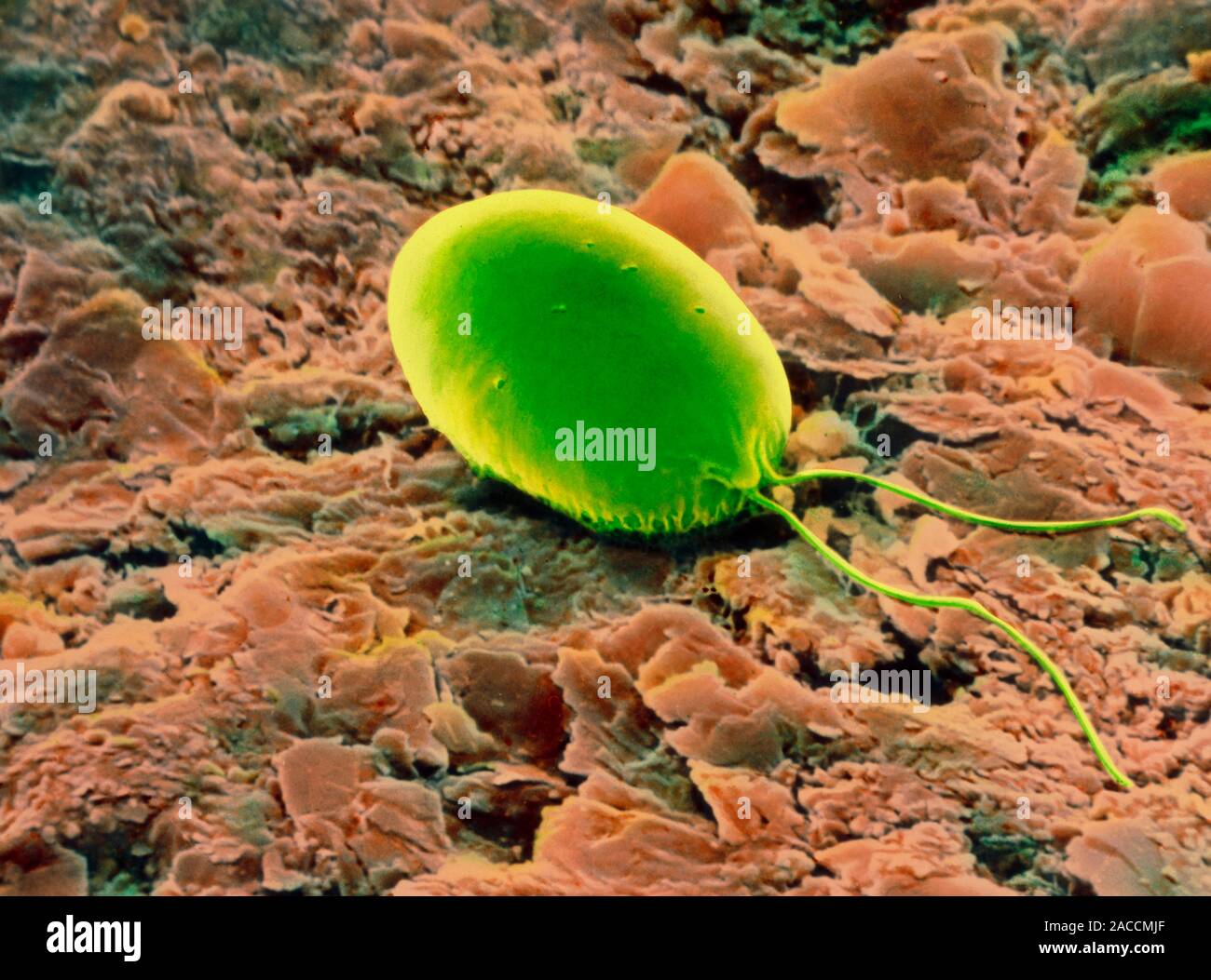 Chlamydomonas chlorostellata. Coloured scanning electron micrograph of the unicellular green freshwater alga, Chlamydomonas chlorostellata, on an unkn Stock Photo