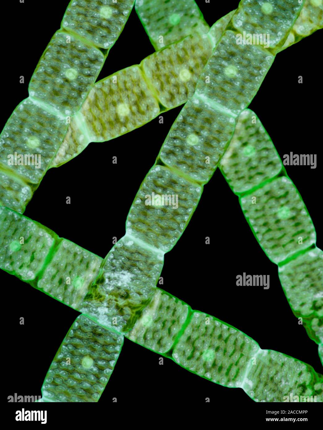 Spirogyra algae. Light micrograph of filaments from a Spirogyra sp
