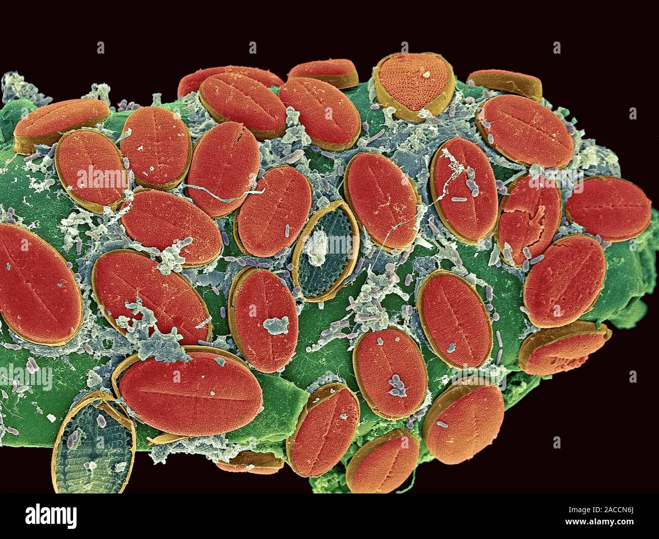 Diatom algae. Coloured scanning electron micrograph (SEM) of diatoms ...