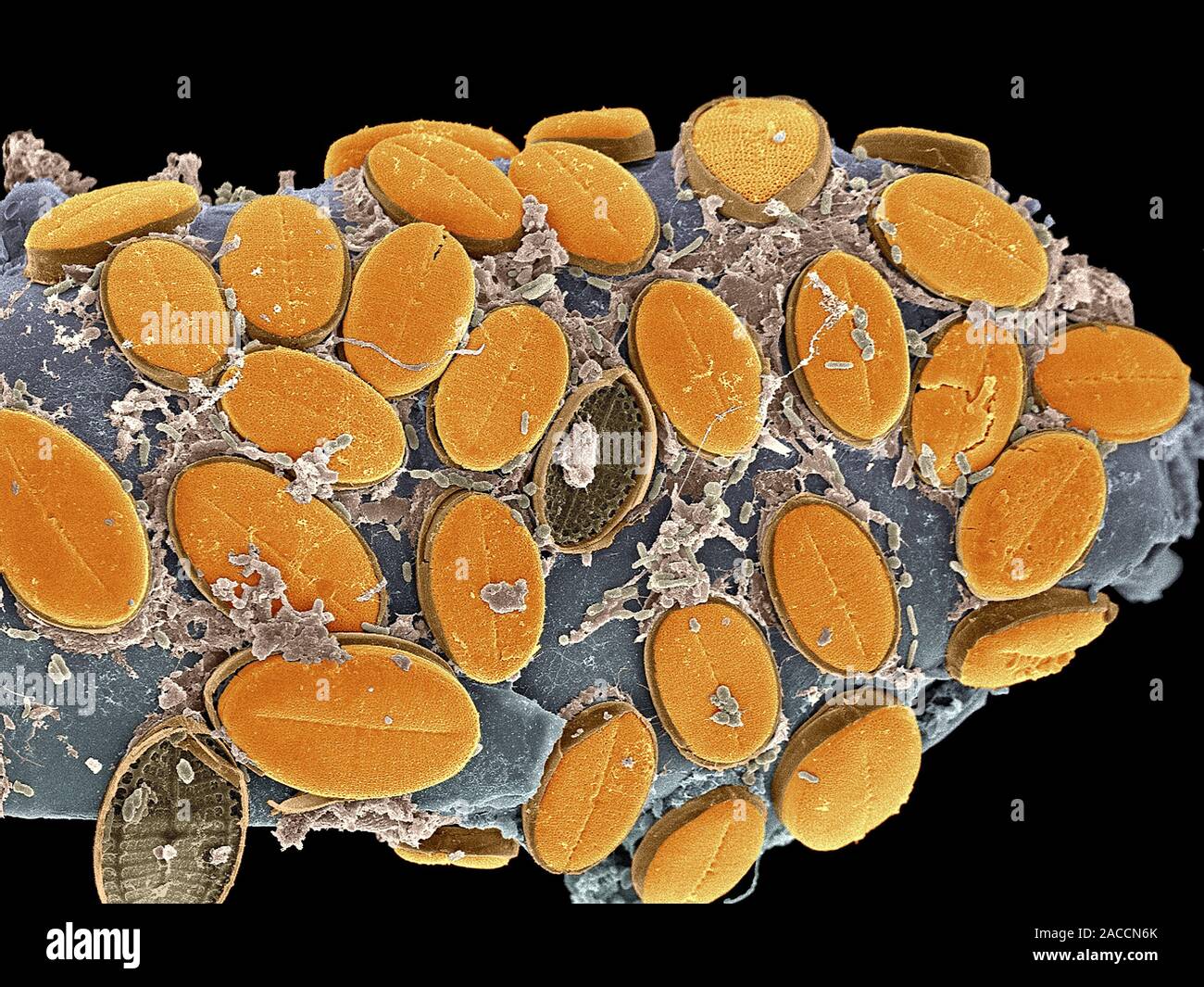 Diatom algae. Coloured scanning electron micrograph (SEM) of diatoms ...