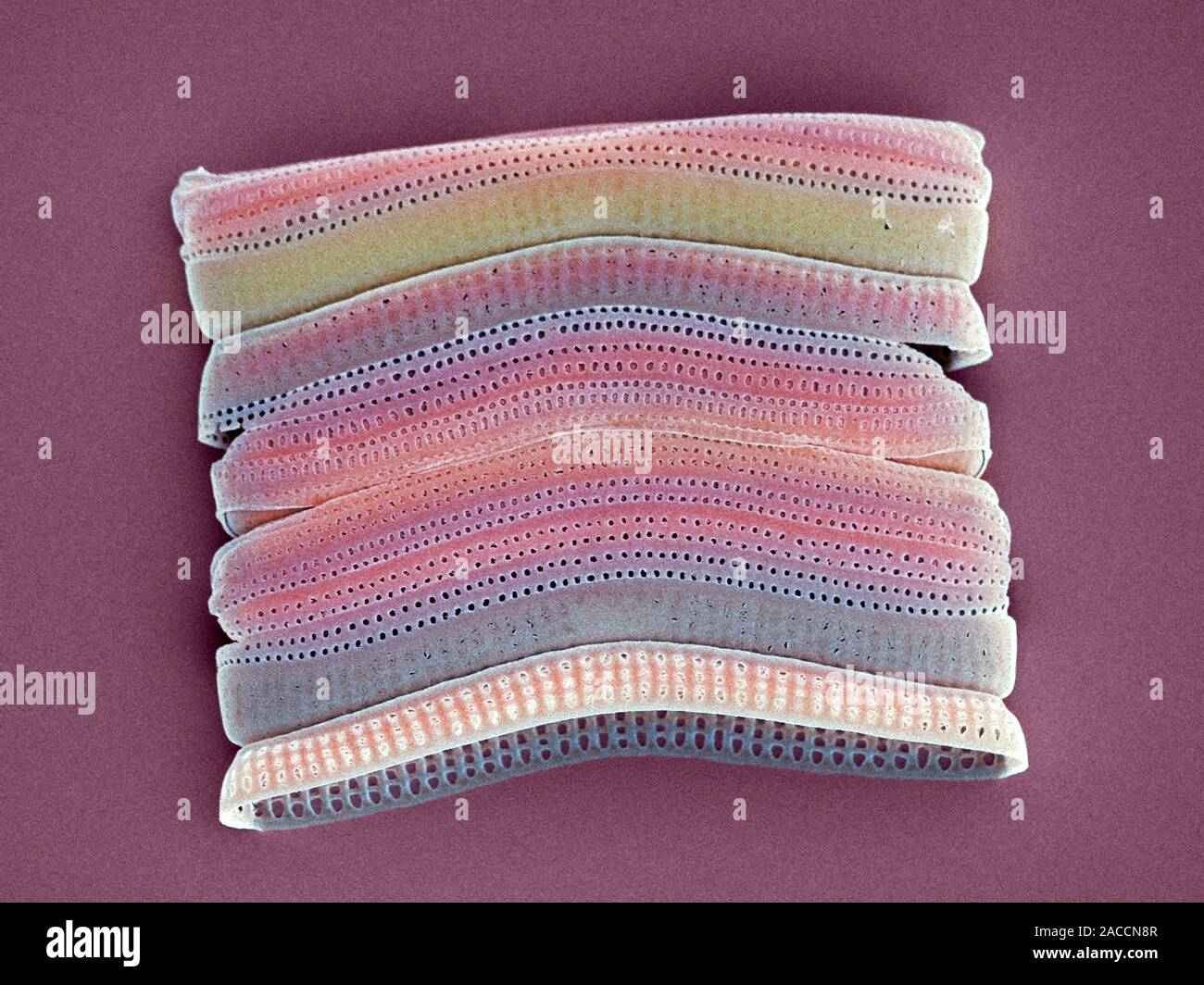 Colonial diatom. Coloured scanning electron micrograph (SEM) of a ...