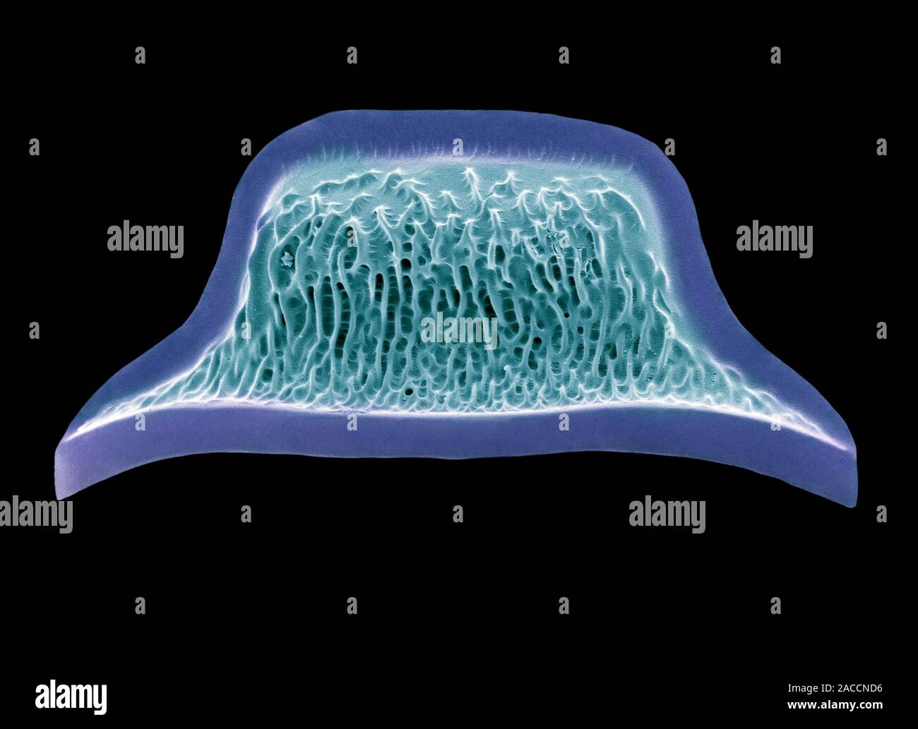Diatom. Coloured scanning electron micrograph (SEM) of a diatom ...