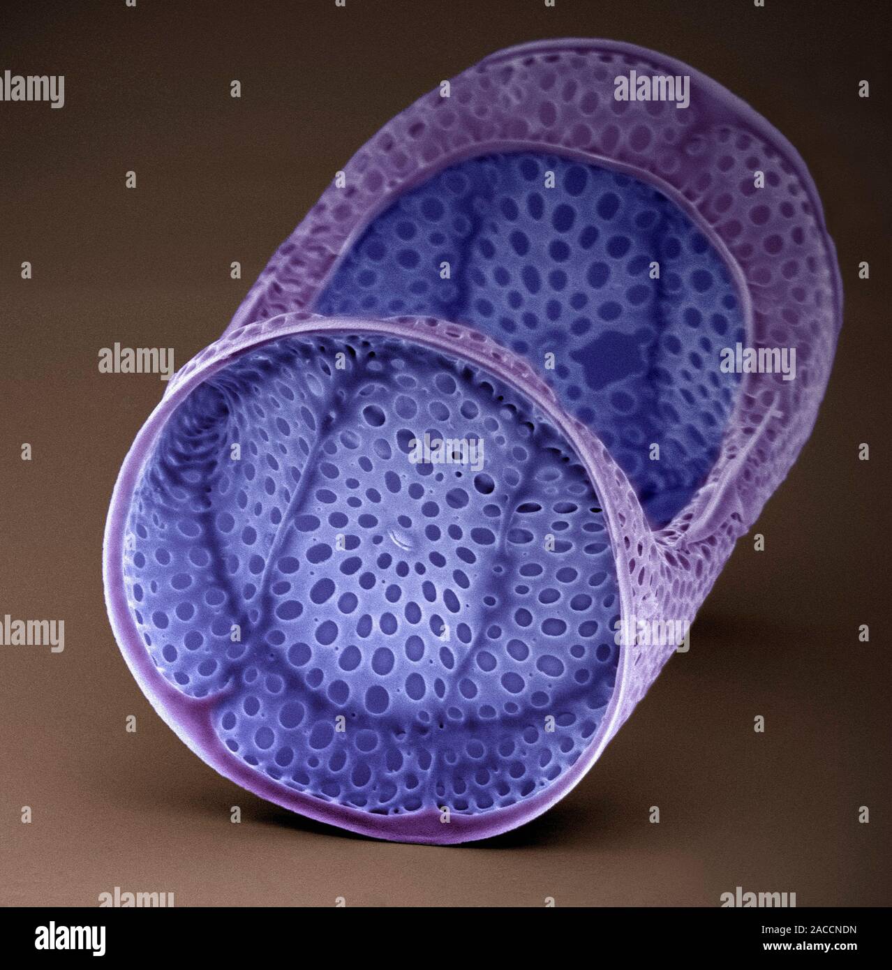 Diatom. Coloured scanning electron micrograph (SEM) of a diatom ...