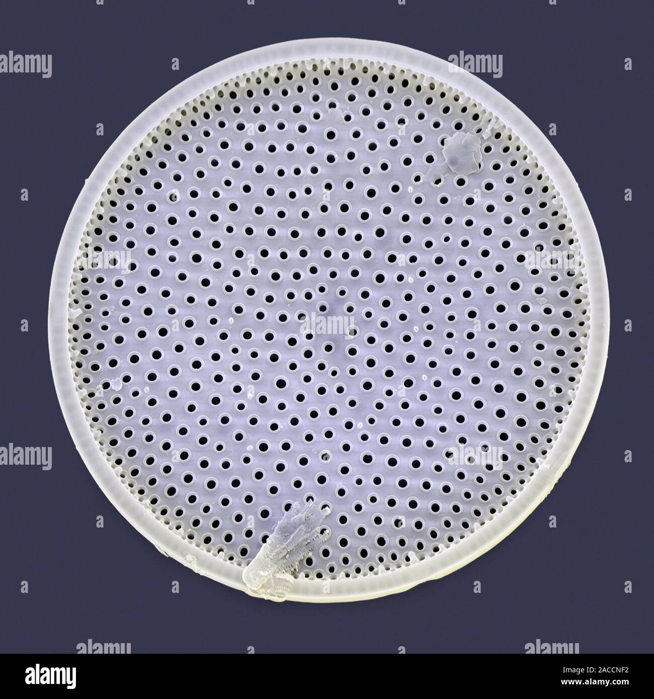 Diatom. Coloured scanning electron micrograph (SEM) of a diatom ...