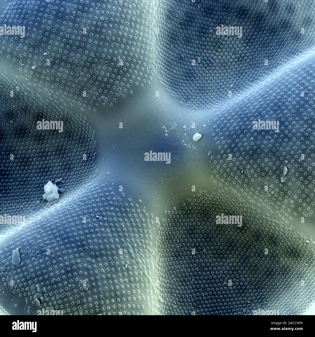 Diatom. Coloured scanning electron micrograph (SEM) of the centre of a ...