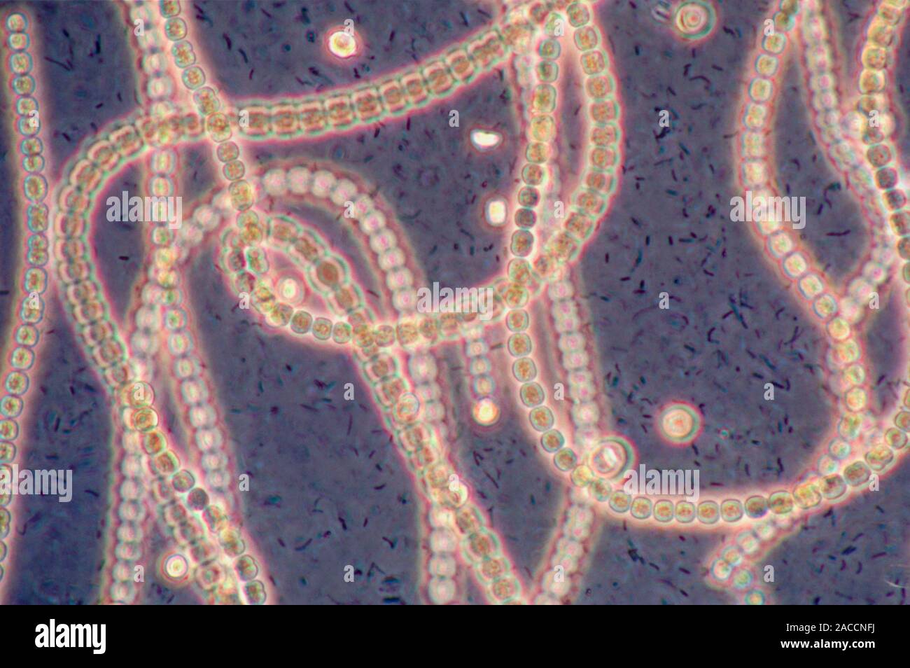 Light micrograph of Nostoc, a bluegreen algae and nitrogenfixing