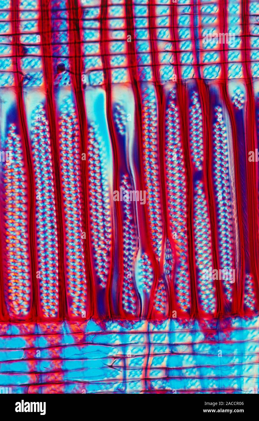 Light micrograph (radial longitudinal section) of the wood of a ...