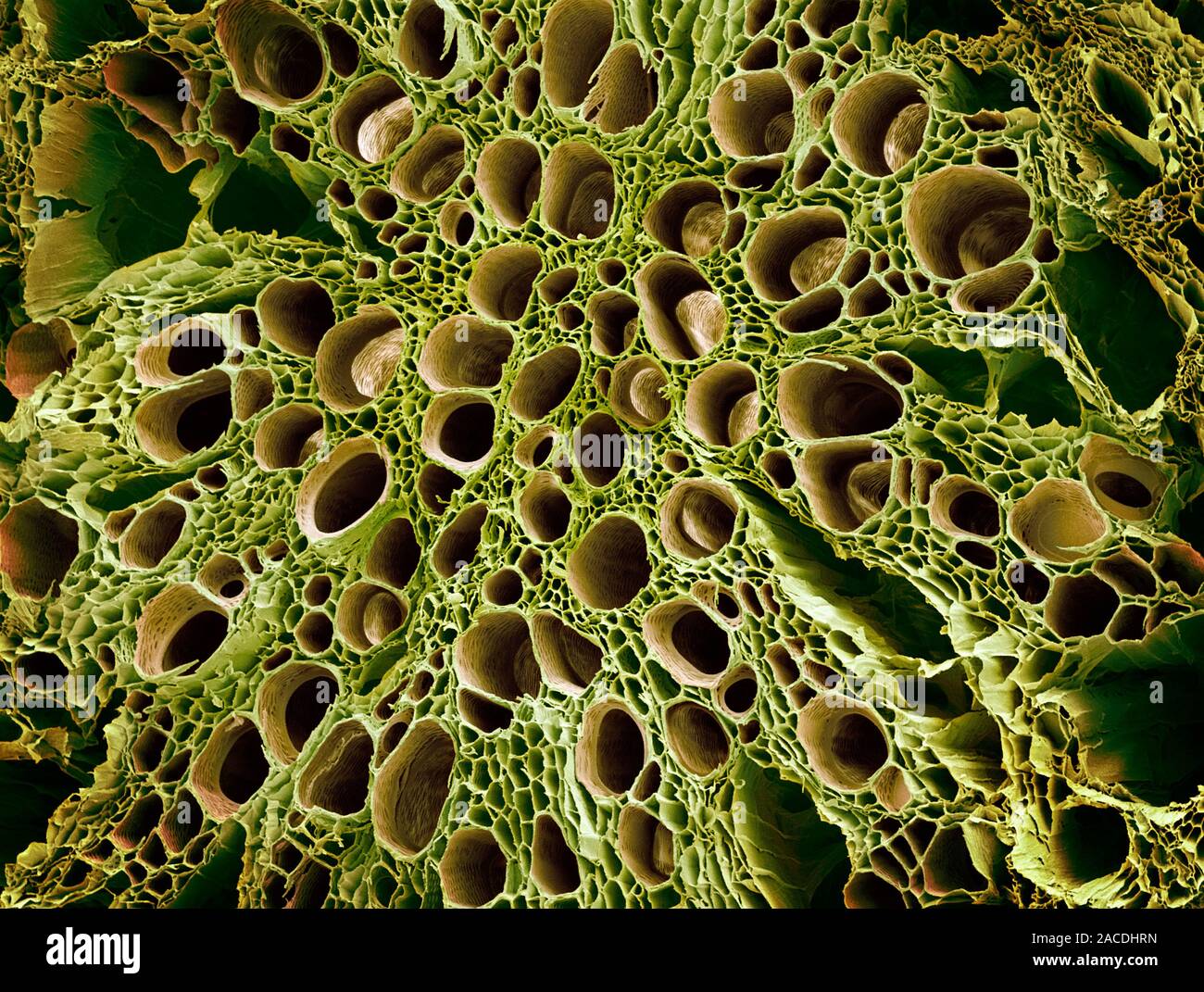 Механическая ткань растений сосуды. Ксилема микроскоп. Ксилема микрофотография. Растений флоэма Ксилема микроскоп. Флоэма в микроскоп.