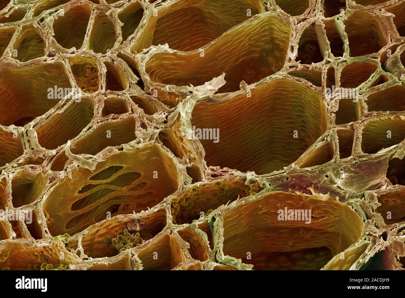 Xylem plant cells. Coloured scanning electron micrograph (SEM) of xylem