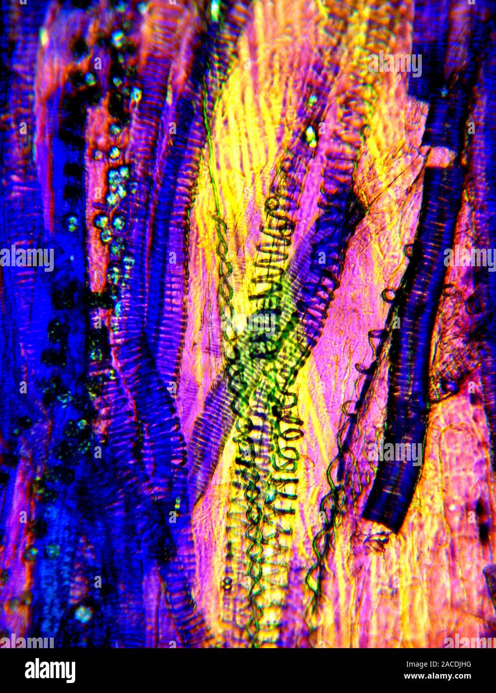 Nettle leaf stalk structures. Polarised light micrograph (LM) of a nettle leaf (Urtica dioica