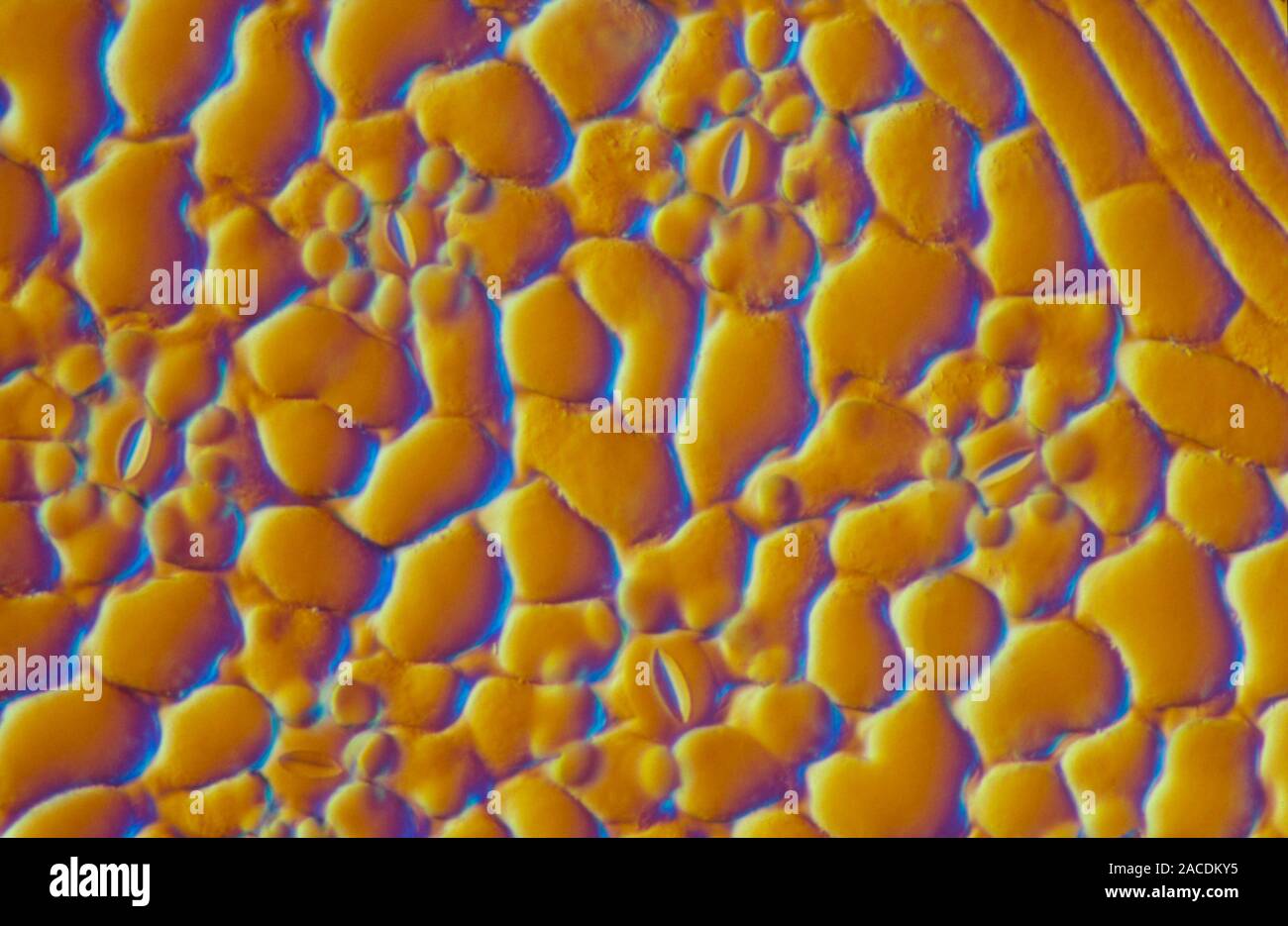 Light micrograph of the surface of a leaf of the sycamore tree, Acer ...