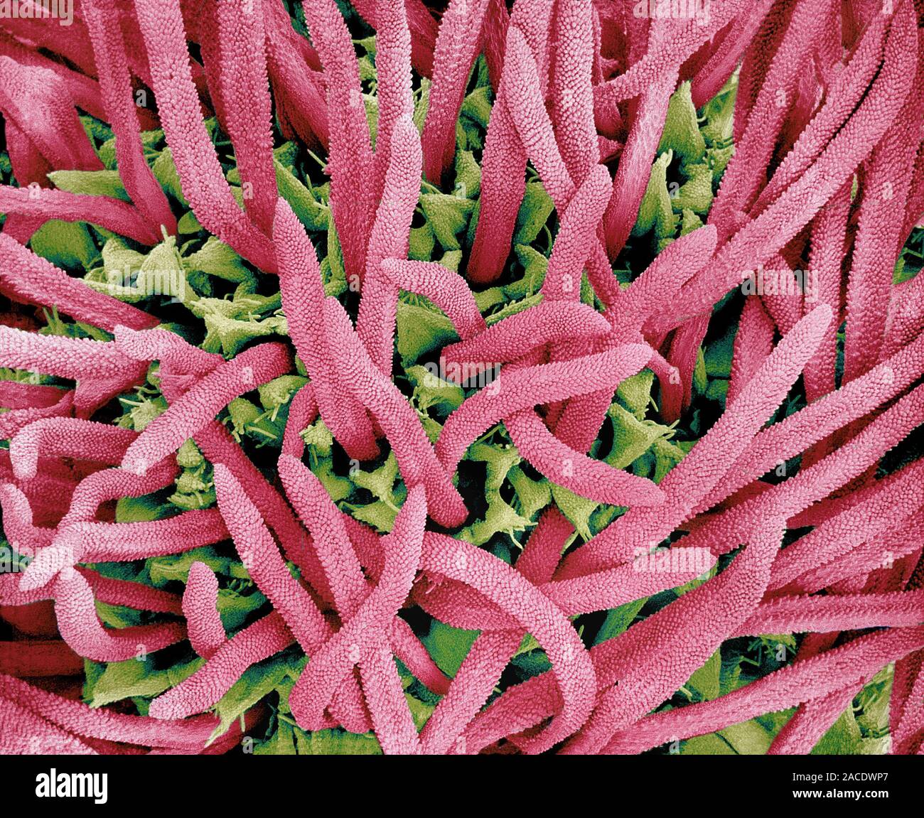 Whiteweed flower floret pistils. Coloured scanning electron micrograph ...